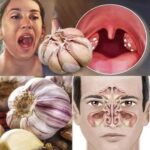 Ajo: El Remedio Natural para el Dolor de Garganta y Sinusitis