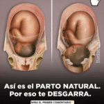 El Parto Natural: Lo Que Realmente Debes Saber