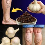 El Poder del Ajo: Remedios Naturales para Aliviar el Dolor de Piernas y Venas Varicosas