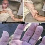 Remedios Caseros para Aliviar el Dolor en el Brazo