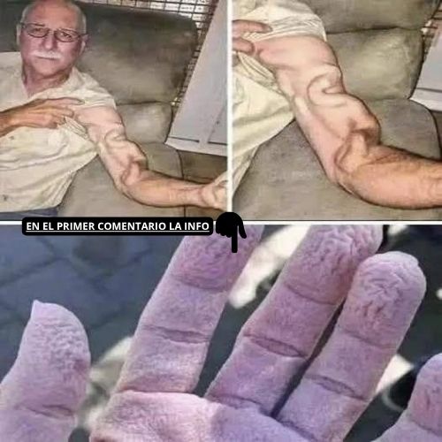 Persona mayor con venas prominentes