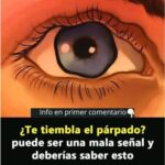 ¿Te Tiembla el Párpado? Señales que No Debes Ignorar