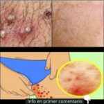 Señales de Crecimiento en la Piel y Remedios Naturales