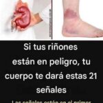 21 Señales de Problemas Renales y Cómo Proteger Tu Salud