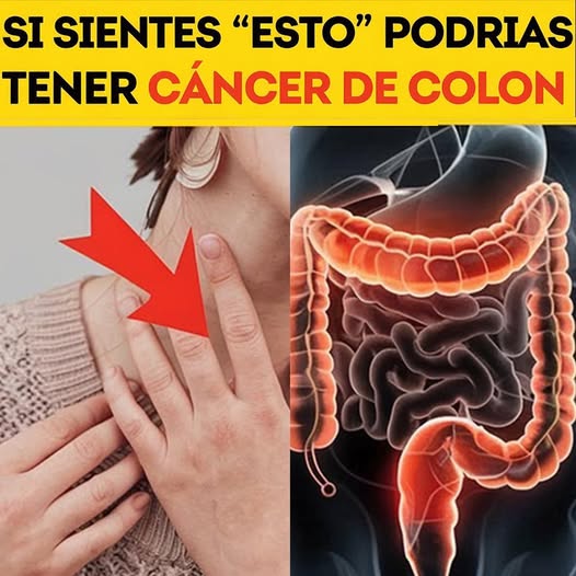 Síntomas de cáncer de colon
