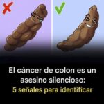6 Señales de Cáncer de Colon que No Debes Ignorar