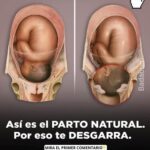 La Realidad del Parto Natural: Lo que No Sabías