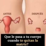 ¿Qué le Pasa a Tu Cuerpo Tras la Extracción del Útero? Consejos y Remedios Naturales