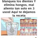 Elimina Hongos y Mal Aliento de Forma Natural y Efectiva