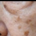 El Impacto de la Falta de Minerales en la Piel: Manchas y Remedios Naturales