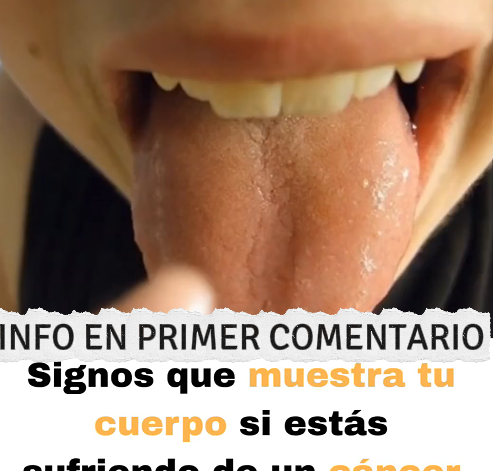 Cáncer de Estómago
