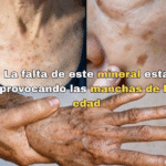 Combatir las Manchas de la Edad con Selenio: Un Enfoque Natural