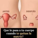 Lo que debes saber sobre los efectos de una histerectomía en tu cuerpo