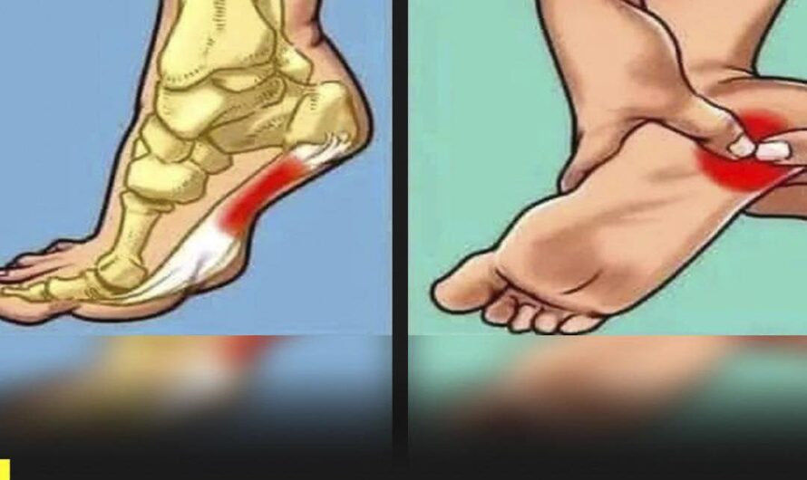 Dolor en el talón: causas comunes, señales de alerta y cómo aliviarlo