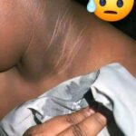 Cuello oscuro: ¿por qué aparece y cómo mejorarlo de forma natural?