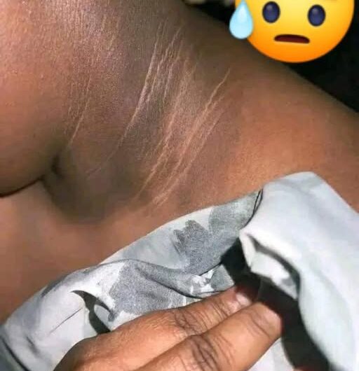 Cuello oscuro: ¿por qué aparece y cómo mejorarlo de forma natural?