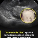 ¿Qué significa “la mano de Dios” en una ecografía? Un mensaje de esperanza y protección