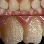 Qué es la amelogénesis?