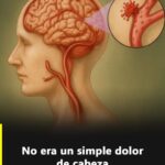 Aneurisma cerebral: señales de alerta, factores de riesgo y por qué un dolor de cabeza puede ser más que una molestia