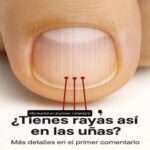 Rayas en las uñas: lo que tu cuerpo podría estar tratando de decirte