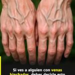 ¿Por qué se ven tus venas más de lo normal? Lo que tu cuerpo podría estar tratando de decirte