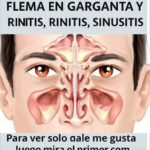 Elimina el moco y la flema: remedios caseros para la rinitis y la salud respiratoria