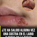 Costra en los labios: las causas más comunes y cuándo realmente deberías prestar atención