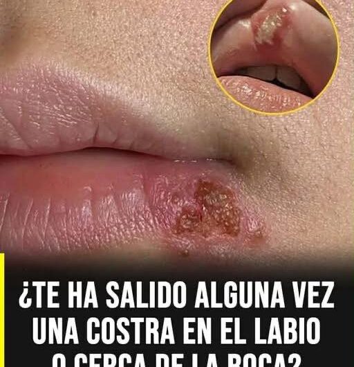 Costra en los labios: las causas más comunes y cuándo realmente deberías prestar atención