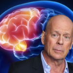 Bruce Willis: el diagnóstico que puso atención sobre la demencia frontotemporal