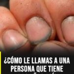 Uñas y salud: señales comunes que muchas personas pasan por alto