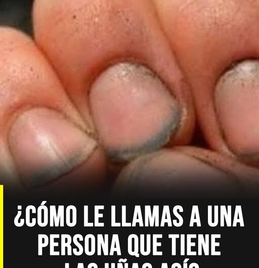 Uñas y salud: señales comunes que muchas personas pasan por alto
