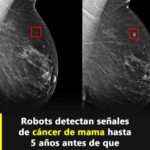 La inteligencia artificial y su papel en la mejora del diagnóstico del cáncer de mama