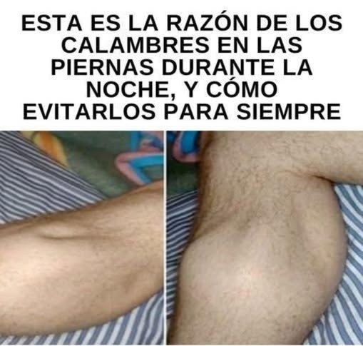 La explicación detrás de los calambres frecuentes en piernas y manos