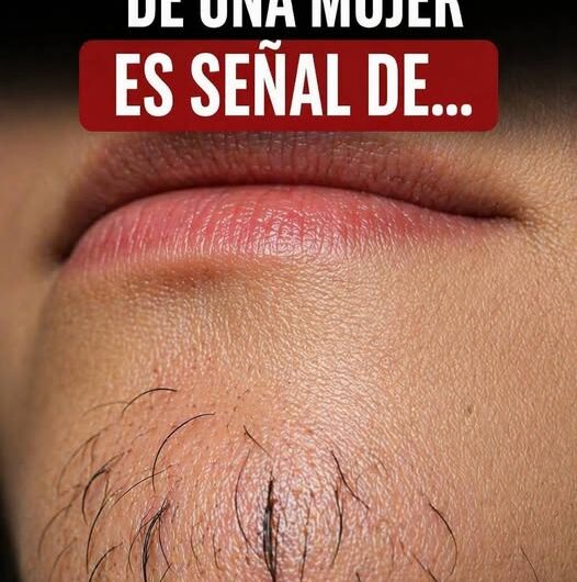 Cambios hormonales y vello facial en mujeres: qué puede estar detrás de este fenómeno