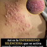 Qué enfermedades pueden evolucionar sin síntomas y cómo favorecer una detección temprana