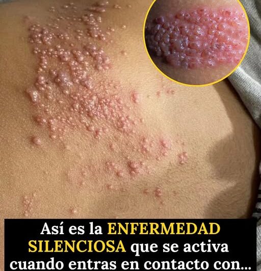 Qué enfermedades pueden evolucionar sin síntomas y cómo favorecer una detección temprana