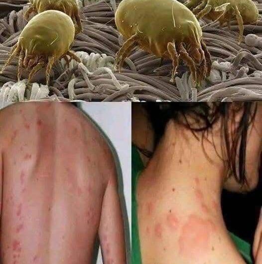 Insectos en la Cama: Lo Que Pueden Indicar y Cómo Actuar Antes de que el Problema Crezca