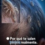 Piojos en la Cabeza: Por Qué Aparecen, Cómo se Contagian y Qué Hacer para Eliminarlos