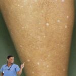 Qué significan las manchas blancas en la piel y cuándo buscar orientación profesional