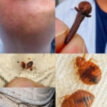 La relación entre los ácaros del polvo y algunos problemas respiratorios frecuentes