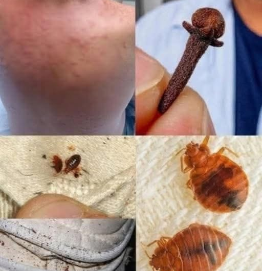 La relación entre los ácaros del polvo y algunos problemas respiratorios frecuentes