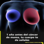 Estos son los síntomas que puedes padecer si tienes cáncer de mama