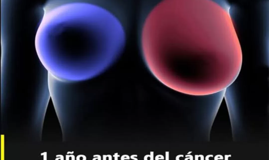 Estos son los síntomas que puedes padecer si tienes cáncer de mama