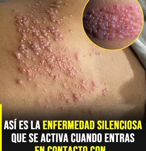 Asma inducida por el ejercicio: síntomas, causas y cómo entrenar con más seguridad