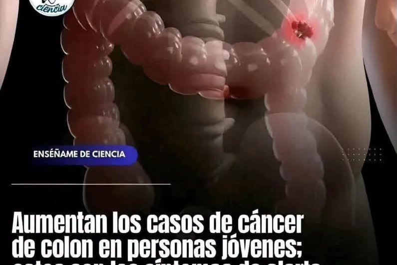 Síntomas de cáncer de colon que no debes ignorar y cuándo consultar al médico