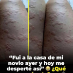 ¿Alergia o moretón? Por qué una fotografía no permite saber qué ocurrió realmente