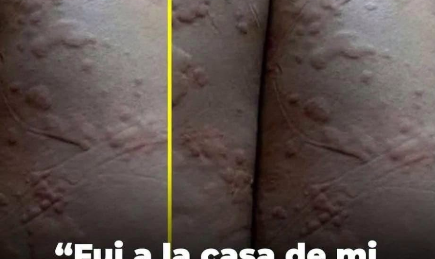 ¿Alergia o moretón? Por qué una fotografía no permite saber qué ocurrió realmente