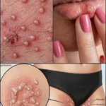 Señales de una posible infección vaginal y cuándo consultar al médico