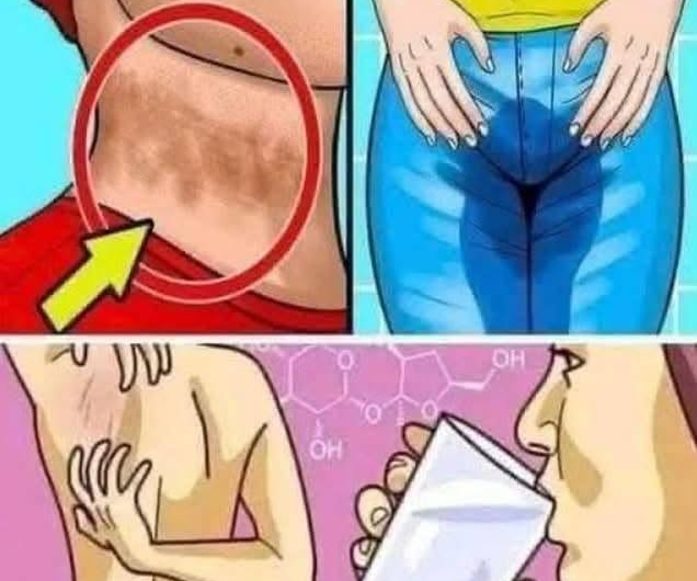 8 señales de glucosa alta en la sangre que no debes ignorar