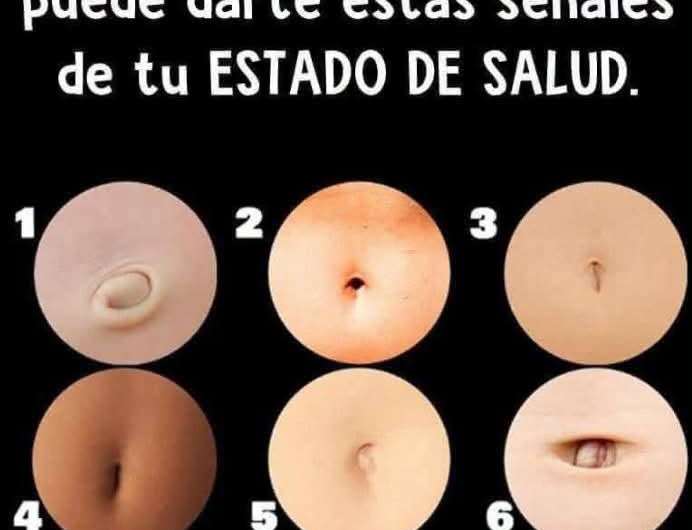 Qué puede indicar la forma del ombligo: cambios normales y señales de alerta